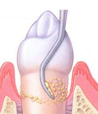 igiene-3