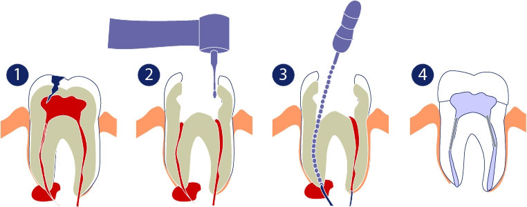 conservativa-3