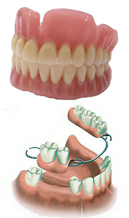 protesi-3-4